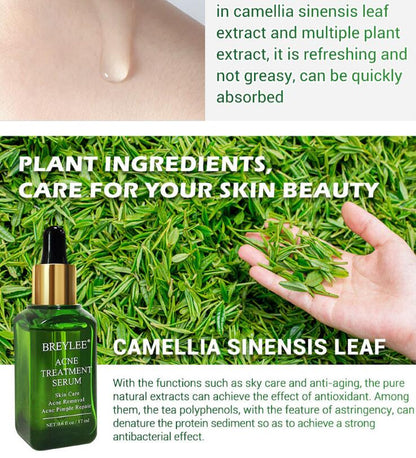 Acne Treatment Serum Facial Repair Oil