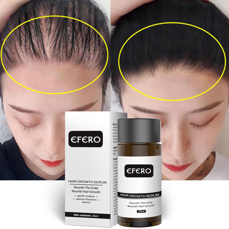 efero hair growth fluid