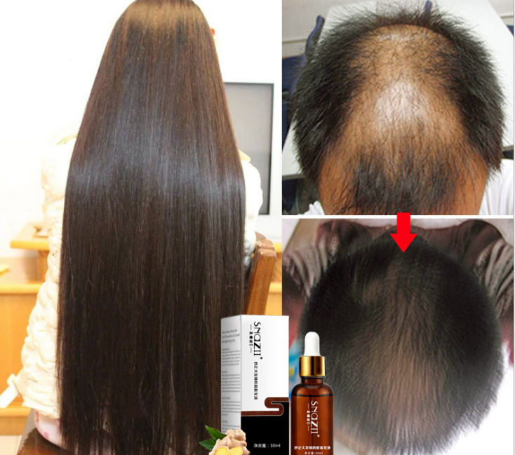 Senna Hair Growth Fluid