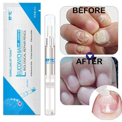 1Pcs Nail Fungal Treatment Pen Anti Fungus Infection Biological Repair Solution Nutritious Oil 3ml Restores Healthy Toenails