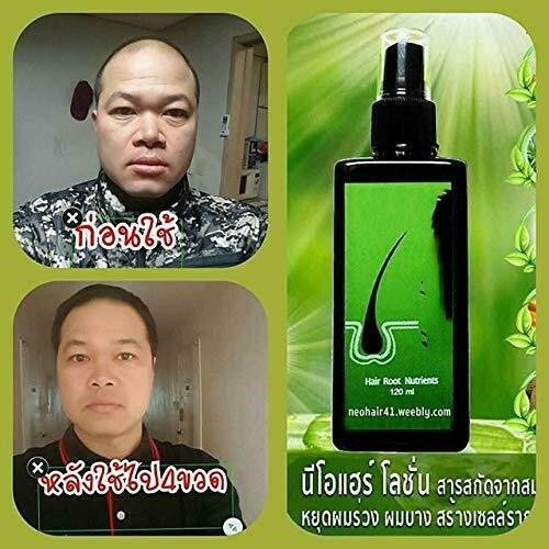 Removing Dandruff, Repairing And Nourishing Shampoo